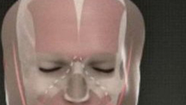 Un eccezionale intervento portato a termine a Parigi