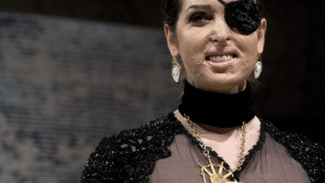 Ballando con le stelle 2018 | Gessica Notaro concorrente