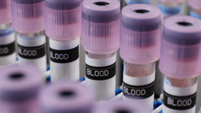 Tumori, la diagnosi precoce passa per gli esami del sangue - Wired - wired.it