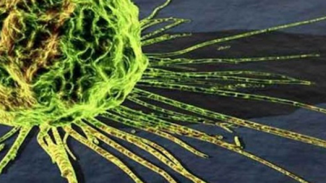 Cur&ograve; cancro al seno con decotti e tisane, causando la morte di una ... - parmapress24.it