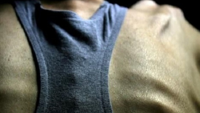 Anoressia maschile, in aumento i casi