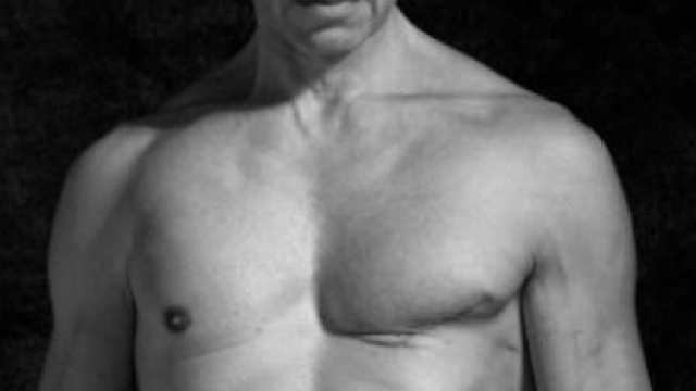 Cancro al seno nell'uomo: il caso di Stefano Saldarelli