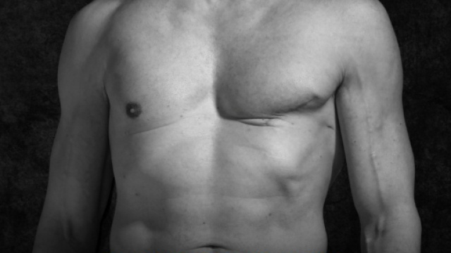 Stefano Saldarelli, 48enne di Prato, ha avuto un cancro al seno. Ora racconta la sua storia per informare gli uomini.