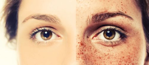 PREVENIR LAS MANCHAS SOLARES EN TU PIEL &ndash; BLOG COASPECO - wordpress.com