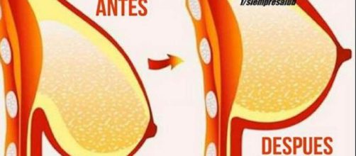 consejos asesinos para ayudarte a escapar de los senos ca&iacute;dos