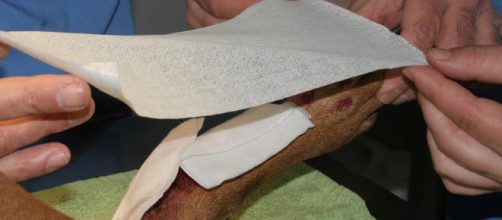 La fascinante forma en que se cre&oacute; el primer vendaje adhesivo