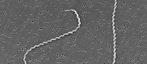 Hallan m&aacute;s especies de bacterias que causan leptospirosis - SciDev ... - scidev.net