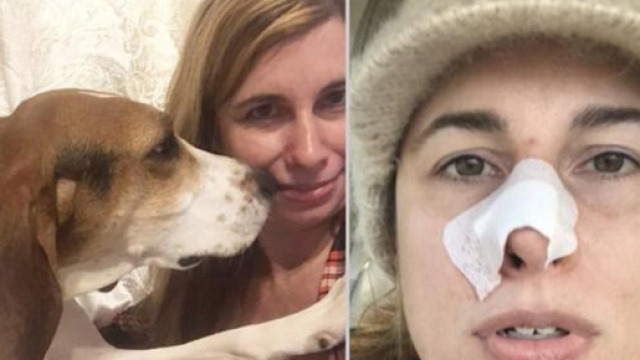 La quarantaduenne americana ed il cane che l'ha salvata dal cancro