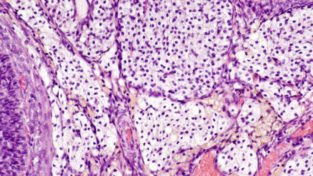 Foto del tessuto interstiziale