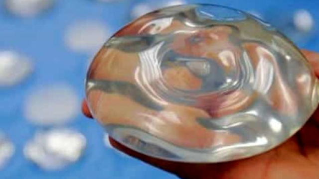 Protesi al seno rovina 20 ragazze: il servizio delle Iene