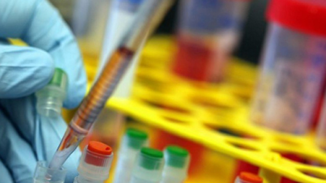 Scoperta la proteina che ferma i tumori