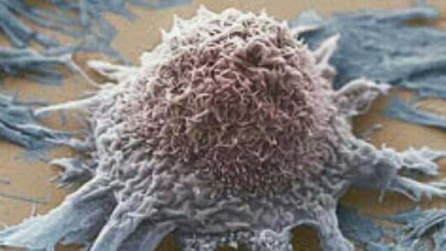 Nuove speranze per la cura dei tumori: annullata l'azione di una proteina che sviluppa le cellule tumorali (fonte infooggi.it )