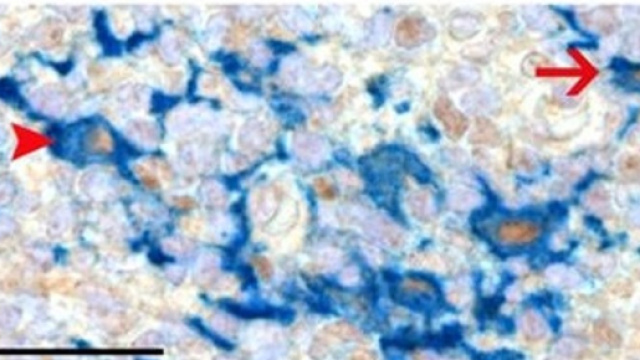 Accoppiamento ERK5-Macrofago (http://www.pnas.org/content/early/2018/02/28/1707929115/tab-figures-data, adattato)