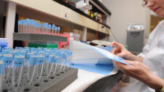 Stampa 3D: addio al tumore senza passare per il cervello