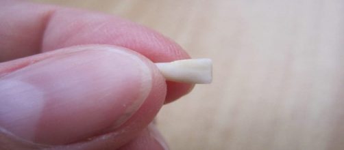 Com os dentes de leite &eacute; poss&iacute;vel armazenar c&eacute;lulas-tronco