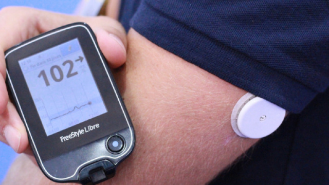 Cerotto per la glicemia ecco come si misurer&agrave; il diabete