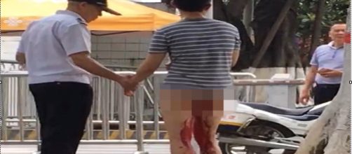 Homem decepa o &oacute;rg&atilde;o sexual ap&oacute;s discuss&atilde;o