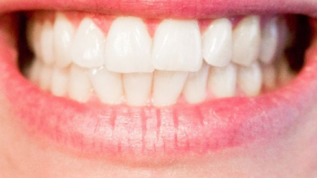 Denti che cadono: cause, rimedi e prevenzione &ndash; Non Solo Salute - nonsolosalute.com