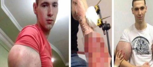 Homem ficou famoso por injetar &oacute;leo no corpo. Ele fez grande sucesso no mundo.