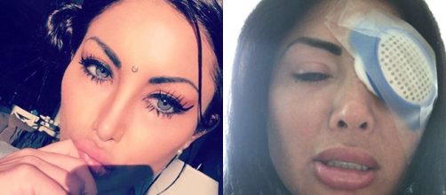 Jovem fica cega ap&oacute;s procedimento errado