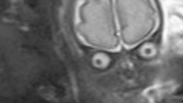 dall'ecografia il bimbo sembrava un marziano