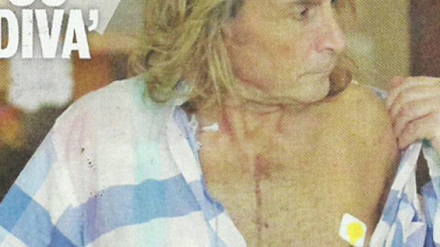 Uomini e Donne: le condizioni di salute di Marco Firpo dopo l'operazione al cuore.