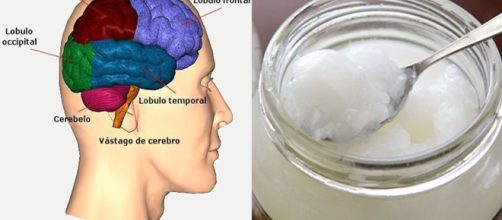 Alzheimer: &iquest;perdida de la memoria o demencia?