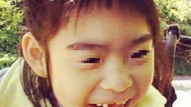 Una rarissima malattia che ha colpito Yuna, sua mamma &egrave; una delle poche studiose al mondo ad occuparsene