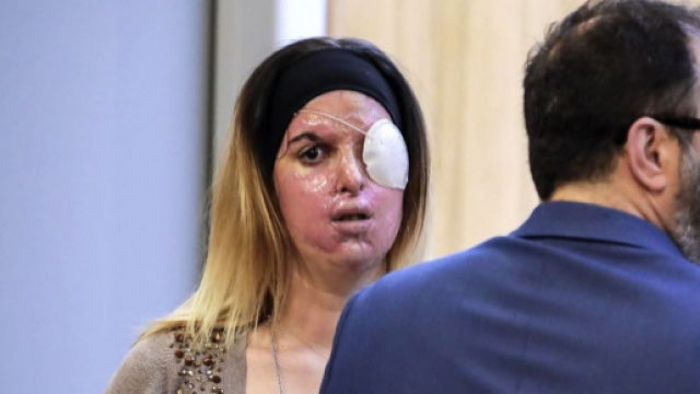 Gessica Notaro, la concorrente di Ballando pedinata