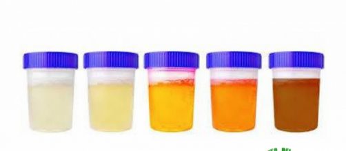 Claro, oscuro, l&iacute;quido, espumoso: as&iacute; es como la orina puede reflejar el estado de su salud.