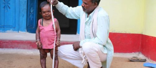 Cuando ten&iacute;a 5 a&ntilde;os dej&oacute; de crecer, hoy en su pueblo es una celebridad con muchos turistas que lo visitan.