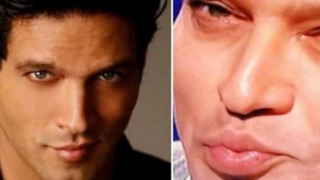 Gabriel Garko: &ldquo;Ma quale rifatto, stavo male&rdquo;. E minaccia querele ... - oggi.it