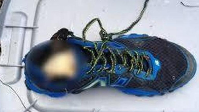 Canada, un altro caso di piede mozzato