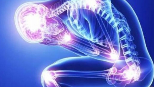 Fibromialgia: cura e come riconoscerla, scopriamo la sindrome sconosciuta che invalida
