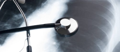 Salud: Cuidado, estos son los primeros s&iacute;ntomas del c&aacute;ncer de pulm&oacute;n