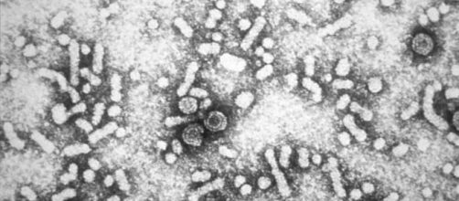 Seg&uacute;n la Organizaci&oacute;n Mundial de la Salud, m&aacute;s de 50 millones de personas mueren cada a&ntilde;o v&iacute;ctimas de enfermedades