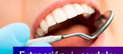 Cuando y porque extraer las cordales o muelas de juicio - Clinica ... - clinicadianadussan.com