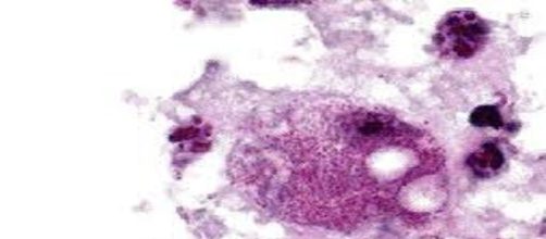 La Fiebre Q: una zoonosis bacteriana de distribuci&oacute;n mundial