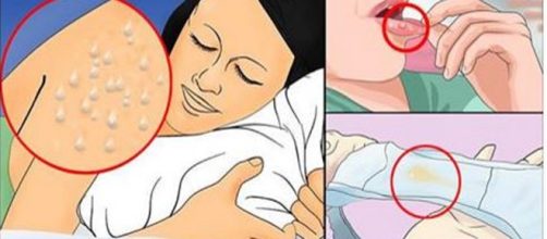 Imagens usada apenas para fins ilustrativos