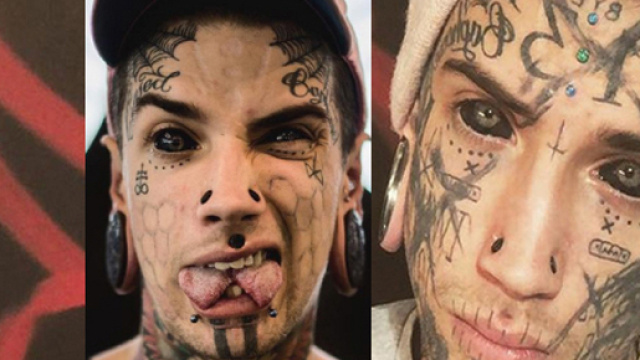 Ethan Bramble si &egrave; sottoposto a 40 interventi, molti dei quali davvero dolorosi