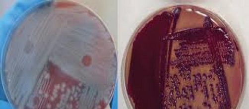 El bacilo del &aacute;ntrax es una mortal bacteria que ha sido usada como arma biol&oacute;gica