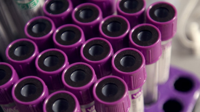 Tumore alla prostata, il grande enigma del test per il Psa - Wired - wired.it