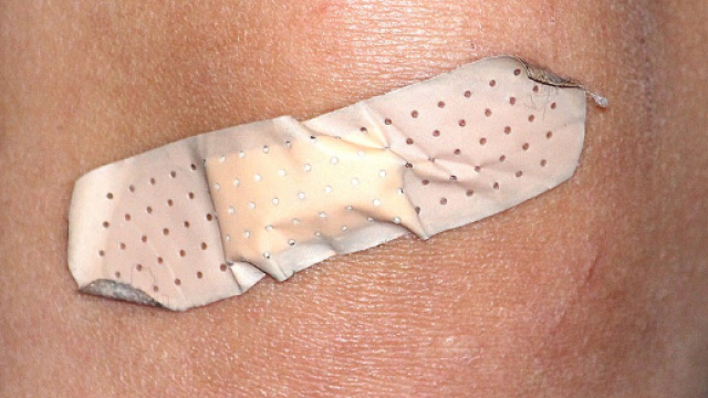 Ragno violino, la testimonianza shock (Ph. Pixabay.com - consuelling)