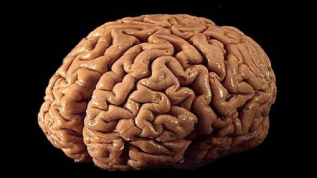 Cervello umano in un adulto sano