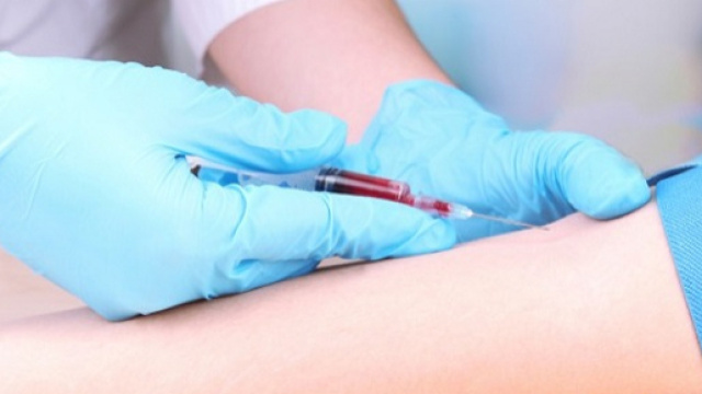 In arrivo un nuovo test del sangue per la diagnosi del tumore alla prostata
