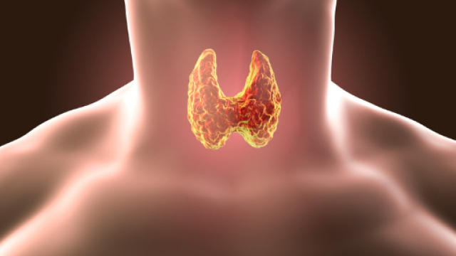 Ipertiroidismo e depressione: il legame tra i due disturbi