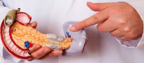 Detecci&oacute;n y tratamientos para el c&aacute;ncer de p&aacute;ncreas