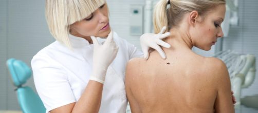 Se&ntilde;ales que pueden indicar que tienes c&aacute;ncer de piel: una ... - elconfidencial.com