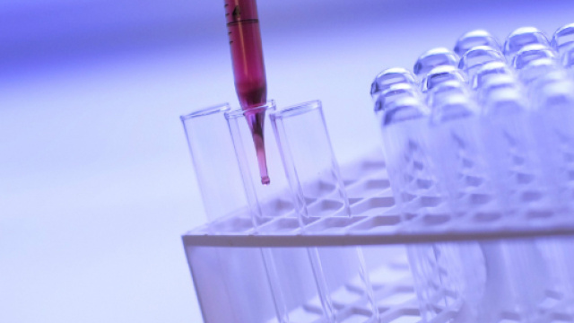 Cancro ai polmoni curabile senza chemio grazie all'immunoterapia.