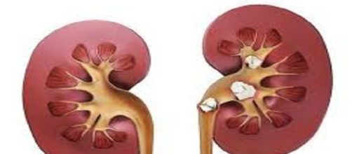 Afecta tanto a hombres como mujeres a cualquier edad, m&aacute;s frecuente en hombres.